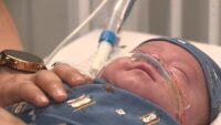 How scent cloths can help San Antonio babies treated in intensive care heal faster