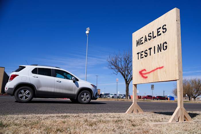 Track the latest measles numbers in Texas