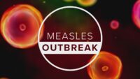 Ector County Health Department undergoes contact tracing amid confirmed measles case