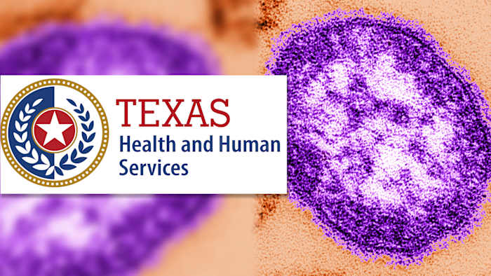 State health officials say no measles case at Cibolo charter school