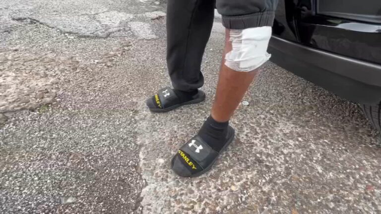 Houston residents terrorized by pack of dogs, one in critical condition