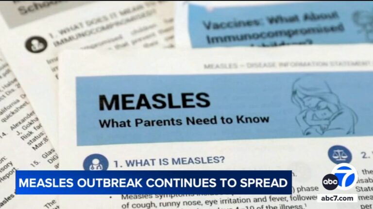 Measles cases reach nearly 300 total in Texas and New Mexico. Here's what you should know
