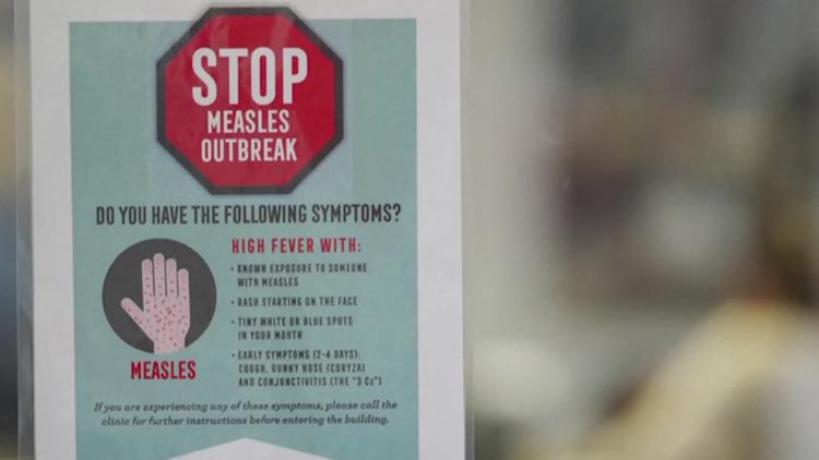 CCISD, health district have plans in place as measles, Spring Break coincide