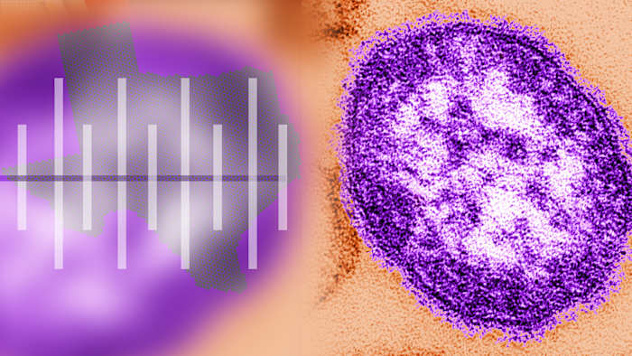 TIMELINE: Measles outbreak in West Texas, potential exposure in Bexar County