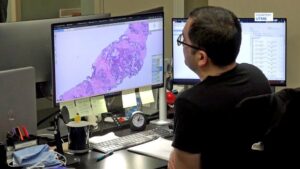 How AI is helping to save lives when it comes to cancer
